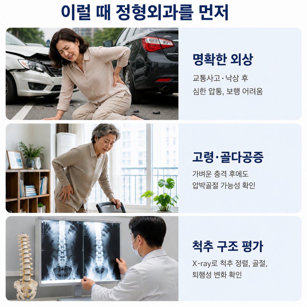 이럴 때 정형외과를 먼저 - 명확한 외상, 고령·골다공증, 척추 구조 평가