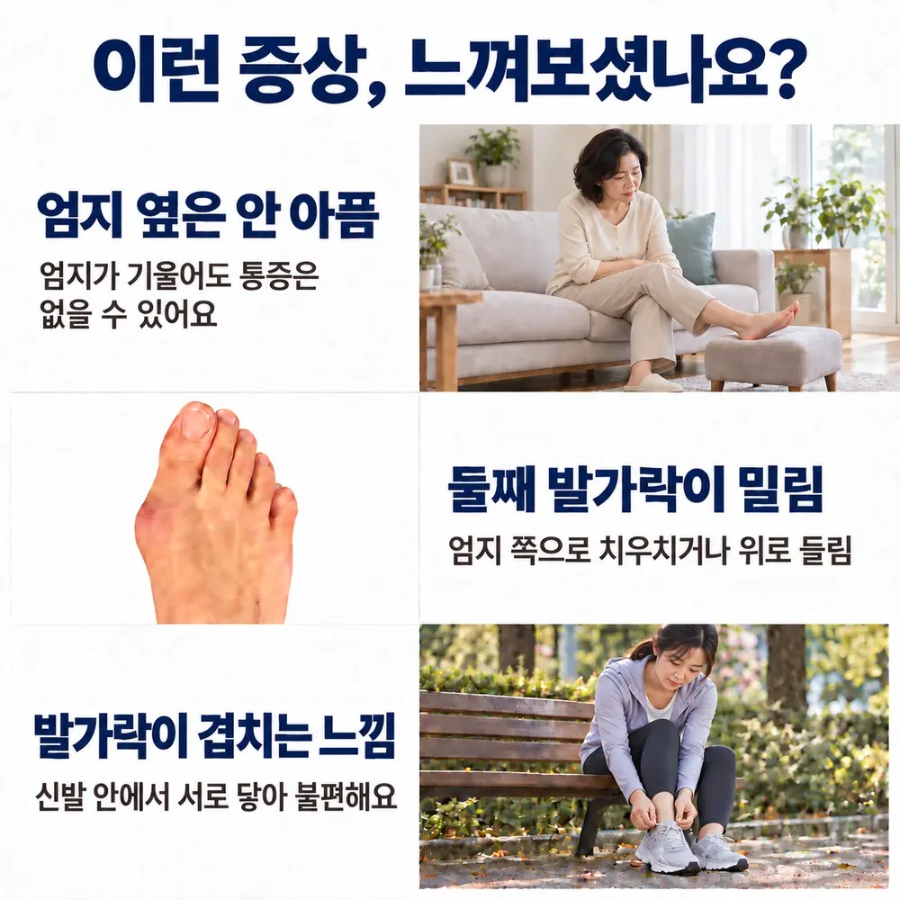 이런 증상, 느껴보셨나요 - 엄지 옆은 안 아픔: 엄지가 기울어도 통증은 없을 수 있어요, 둘째 발가락이 밀림: 엄지 쪽으로 치우치거나 위로 들림, 발가락이 겹치는 느낌: 신발 안에서 서로 닿아 불편해요