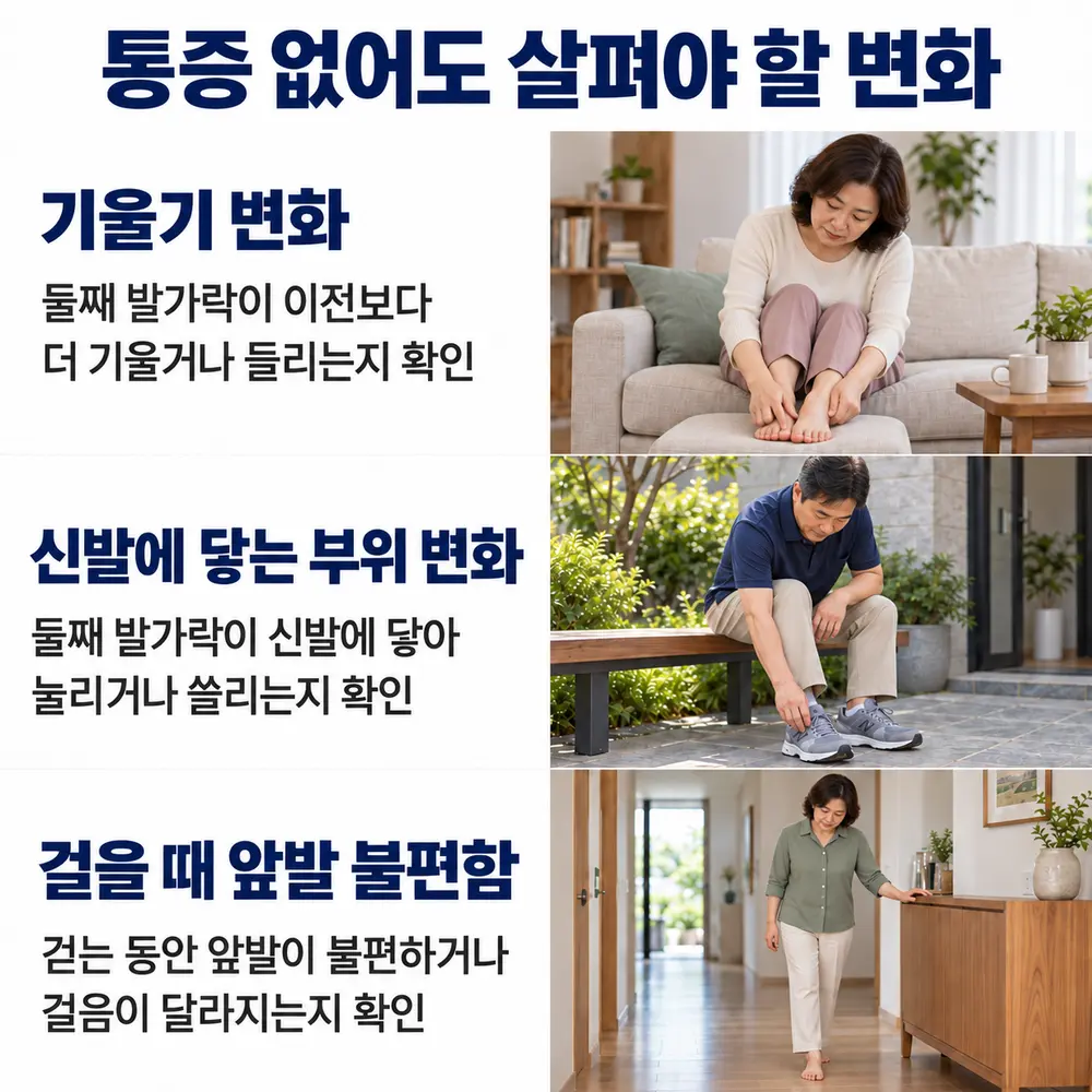 통증 없어도 살펴야 할 변화 - 기울기 변화: 둘째 발가락이 이전보다 더 기울거나 들리는지 확인, 신발에 닿는 부위 변화: 둘째 발가락이 신발에 닿아 눌리거나 쓸리는지 확인, 걸을 때 앞발 불편함: 걷는 동안 앞발이 불편하거나 걸음이 달라지는지 확인