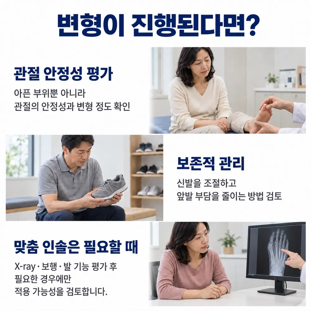 변형이 진행된다면 - 관절 안정성 평가: 아픈 부위뿐 아니라 관절의 안정성과 변형 정도 확인, 보존적 관리: 신발을 조절하고 앞발 부담을 줄이는 방법 검토, 맞춤 인솔은 필요할 때: X-ray·보행·발 기능 평가 후 필요한 경우에만 적용 가능성을 검토