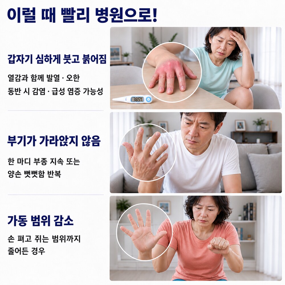 이럴 때 빨리 병원으로 - 갑자기 심하게 붓고 붉어짐, 부기가 가라앉지 않음, 가동 범위 감소