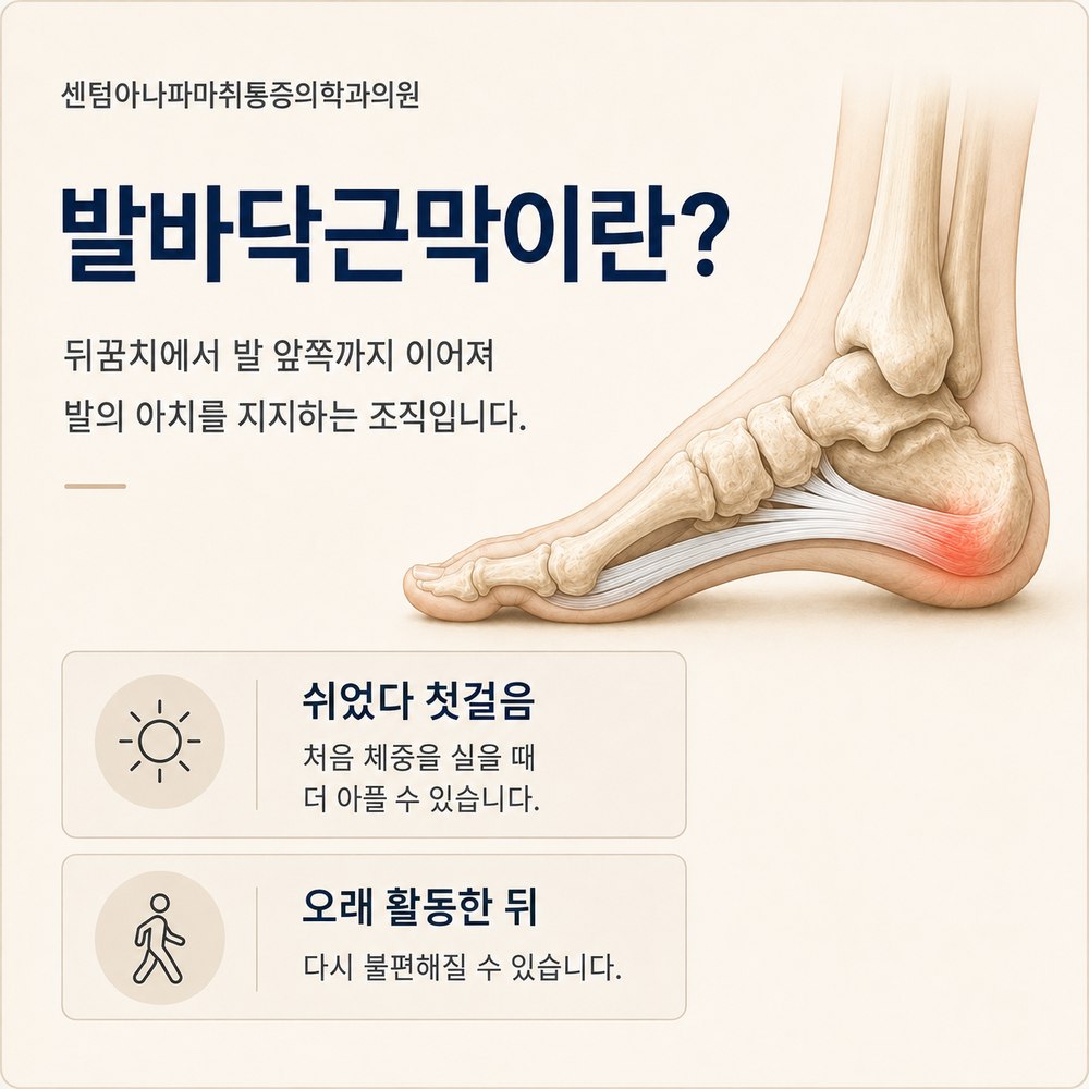 발바닥근막이란 - 뒤꿈치에서 발 앞쪽까지 이어져 발의 아치를 지지하는 조직, 쉬었다 첫걸음과 오래 활동한 뒤 통증