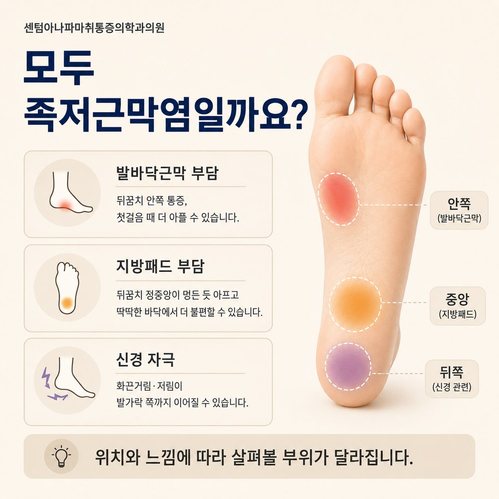 모두 족저근막염일까요 - 안쪽 발바닥근막, 중앙 지방패드, 뒤쪽 신경 자극, 위치와 느낌에 따라 살펴볼 부위가 다름