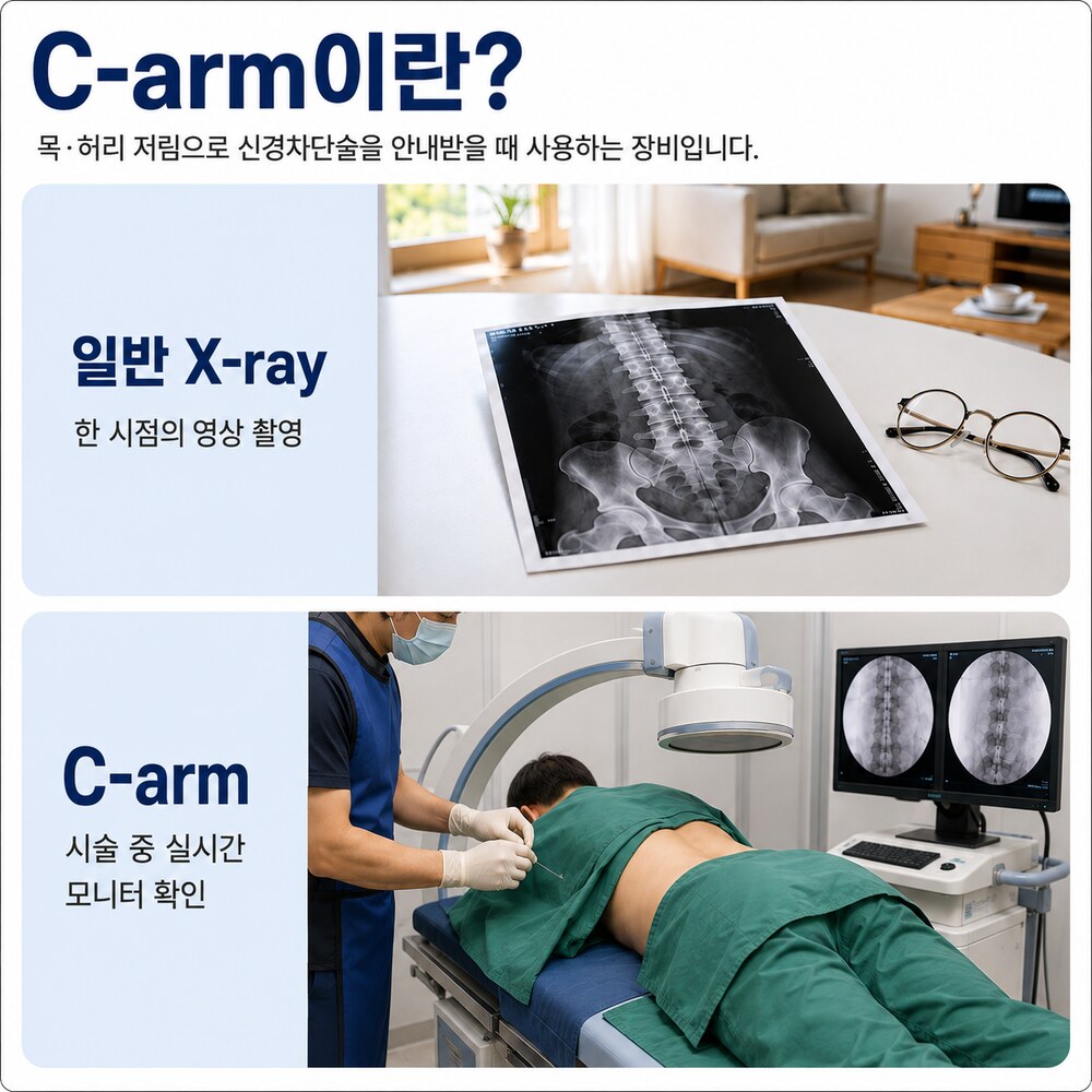 C-arm이란 - 일반 X-ray는 한 시점 영상 촬영, C-arm은 시술 중 실시간 모니터 확인