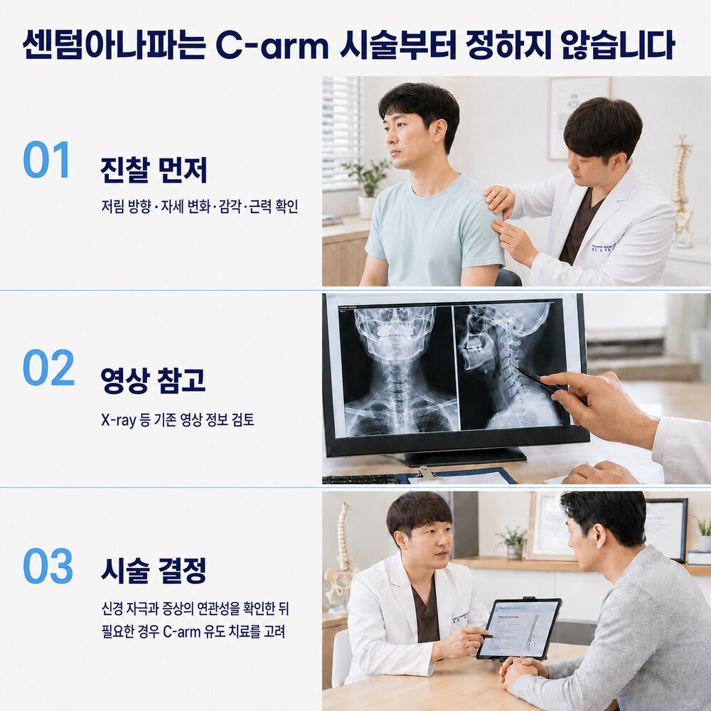 센텀아나파는 C-arm 시술부터 정하지 않습니다 - 진찰 먼저, 영상 참고, 시술 결정 3단계