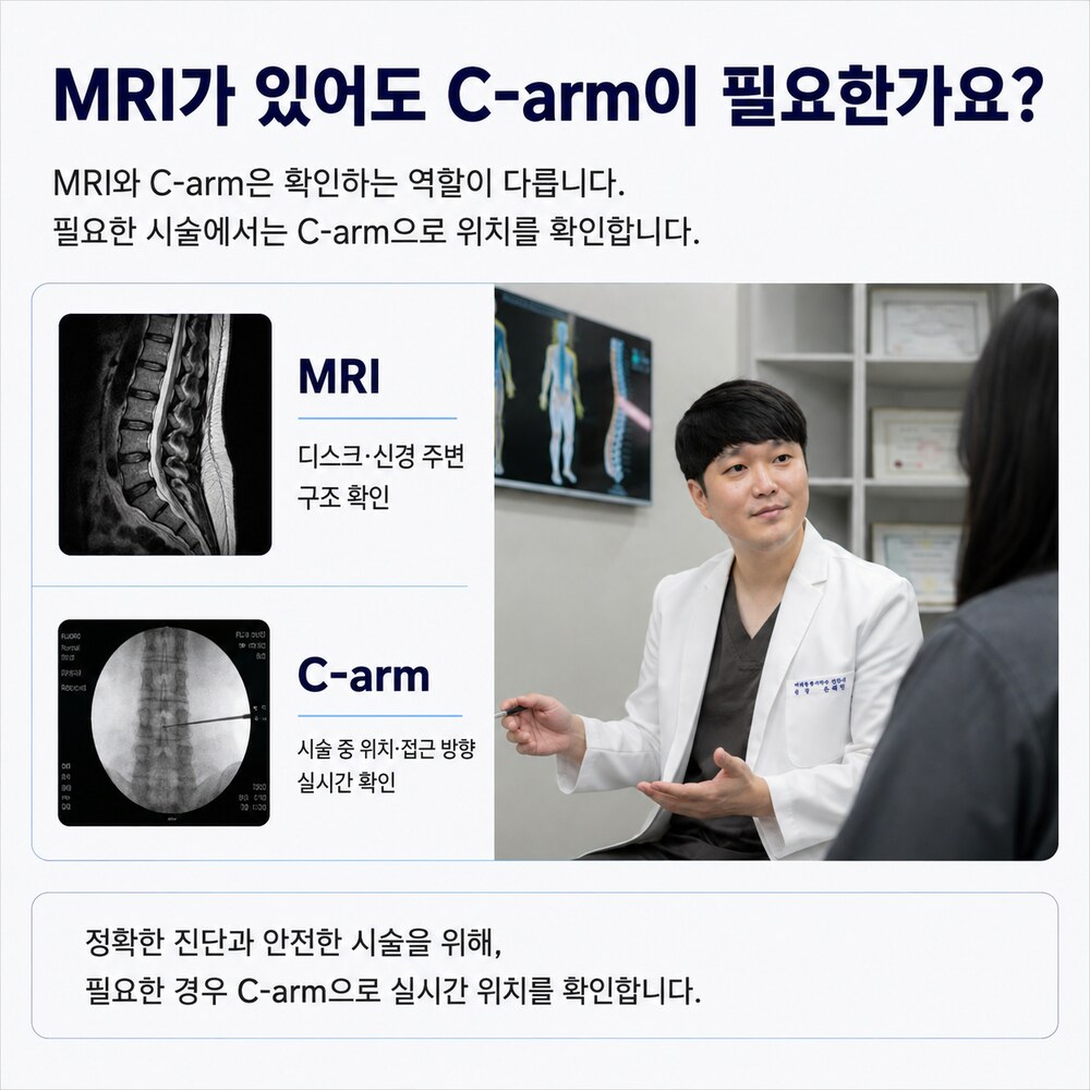 예전에 찍은 MRI가 있어도 C-arm이 필요한가요 - MRI는 디스크·신경 주변 구조 확인, C-arm은 시술 중 위치·접근 방향 확인