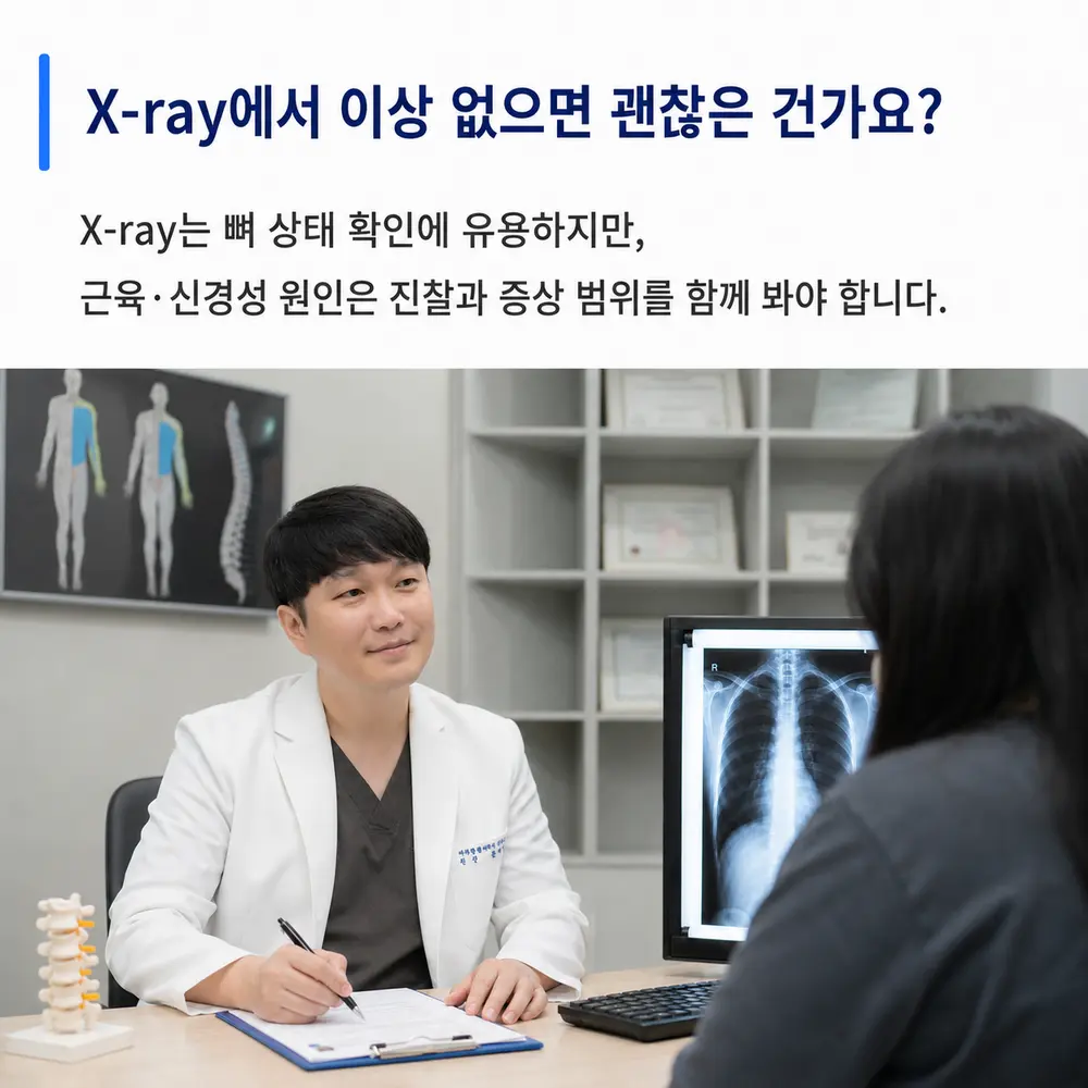 X-ray에서 이상 없으면 갈비뼈 주변은 괜찮은 건가요 - X-ray는 뼈 상태 확인에 유용하지만 근육·신경성 원인은 진찰과 증상 범위를 함께 봐야 함