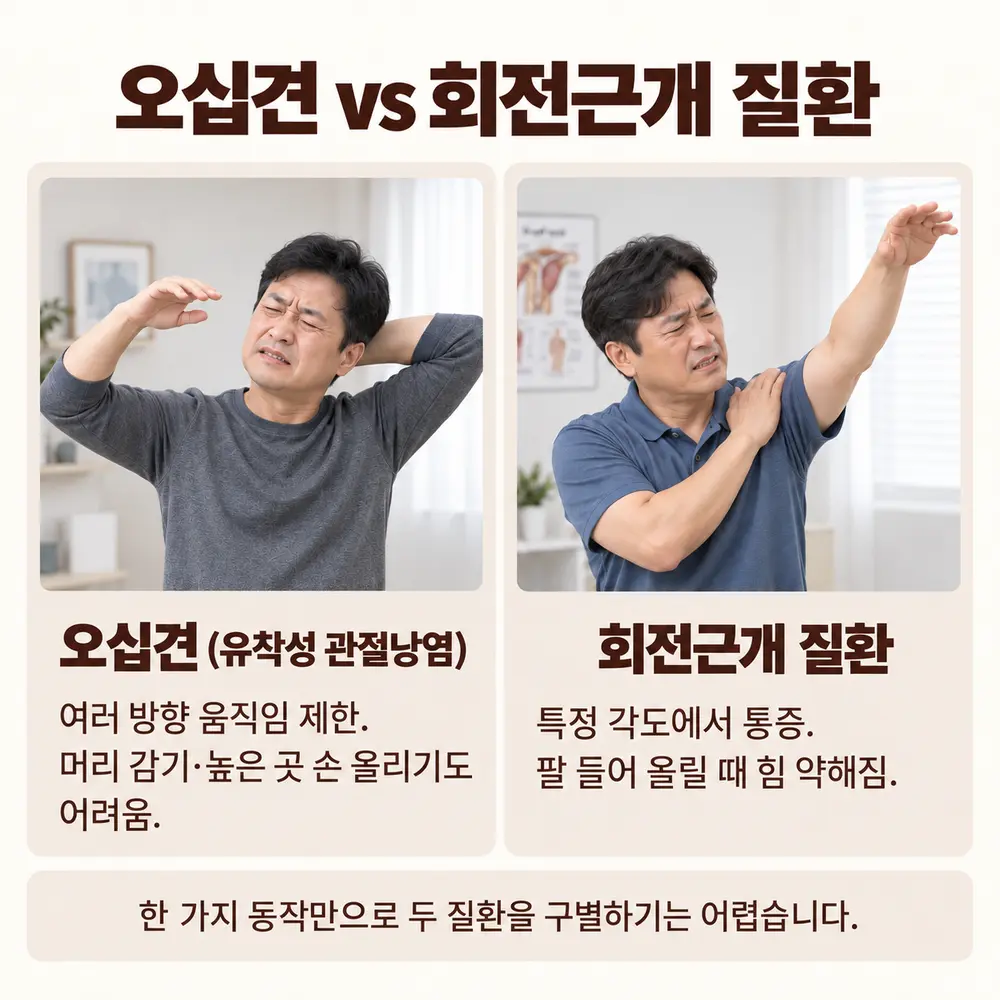 오십견 vs 회전근개 질환 - 오십견(유착성 관절낭염): 여러 방향 움직임 제한, 머리 감기·높은 곳 손 올리기도 어려움, 회전근개 질환: 특정 각도에서 통증, 팔 들어 올릴 때 힘 약해짐, 한 가지 동작만으로 두 질환을 구별하기는 어렵습니다