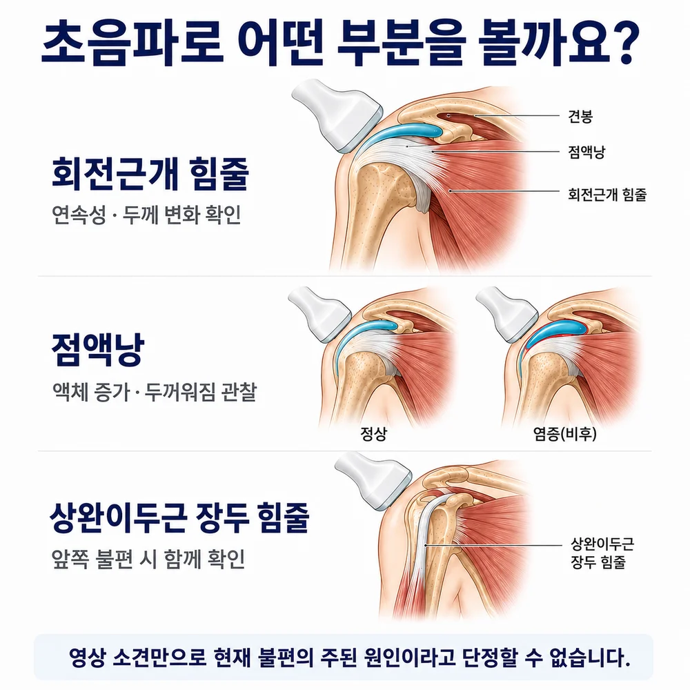 초음파로 어떤 부분을 볼까요 - 회전근개 힘줄 연속성·두께 변화, 점액낭 액체 증가나 두꺼워짐, 상완이두근 장두 힘줄