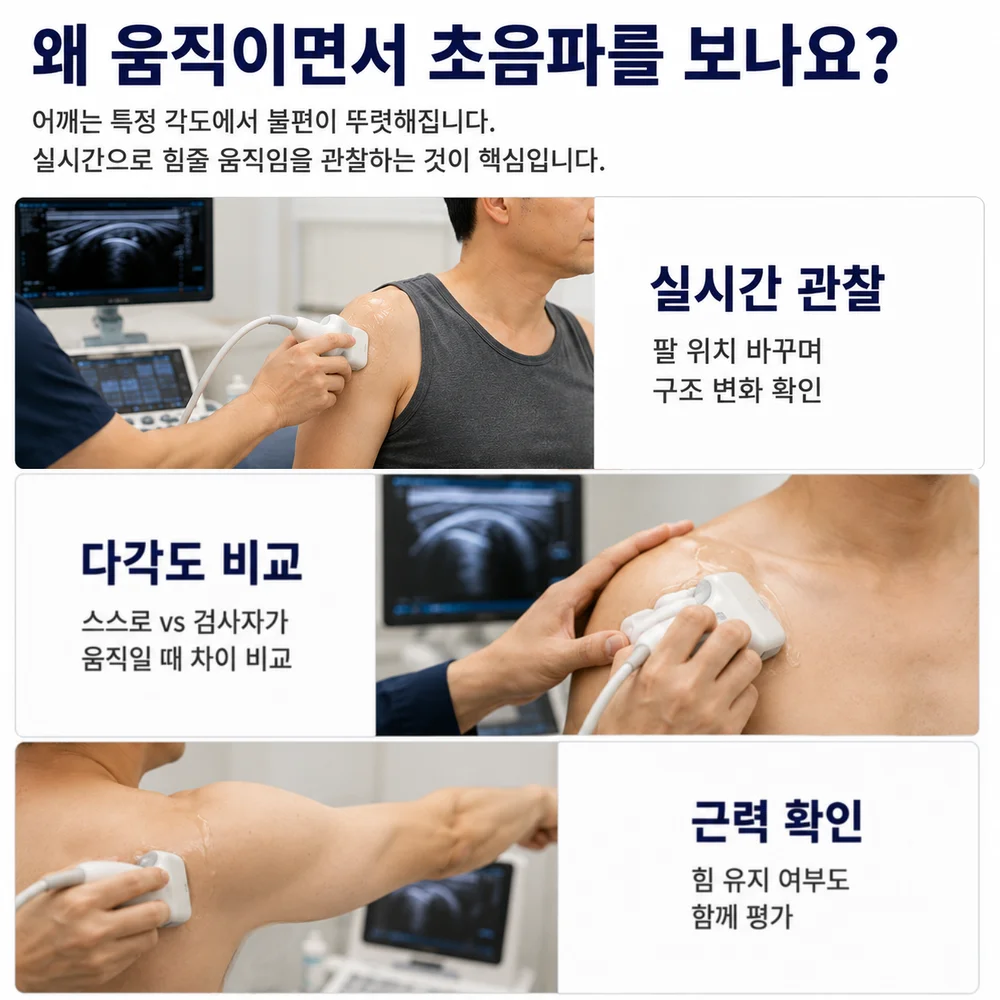 왜 움직이면서 초음파를 보나요 - 팔 위치를 바꾸며 실시간 관찰, 스스로 움직일 때와 검사자가 움직여줄 때 다각도 비교, 근력 확인