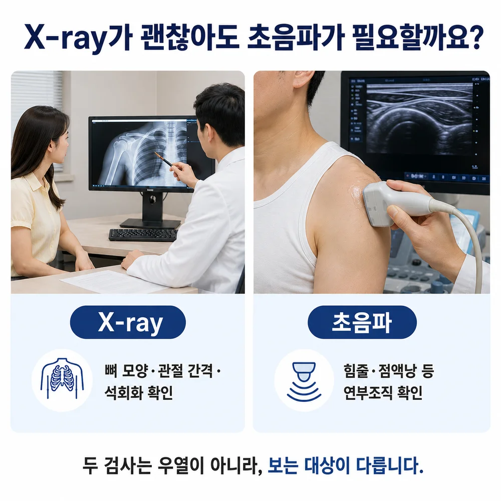 X-ray가 괜찮아도 초음파가 필요할까요 - X-ray는 뼈 모양·관절 간격·석회화 확인, 초음파는 힘줄·점액낭 등 연부조직 확인, 두 검사는 보는 대상이 다름
